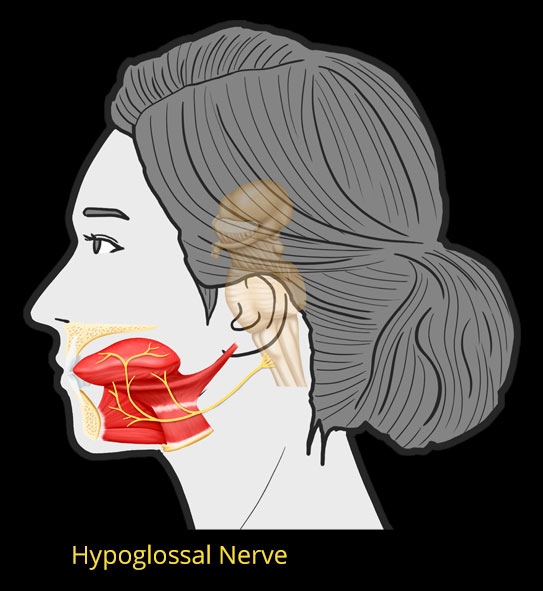 Hypoglossal Sleep Nerve