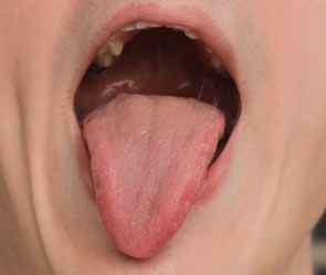 Tongue Block